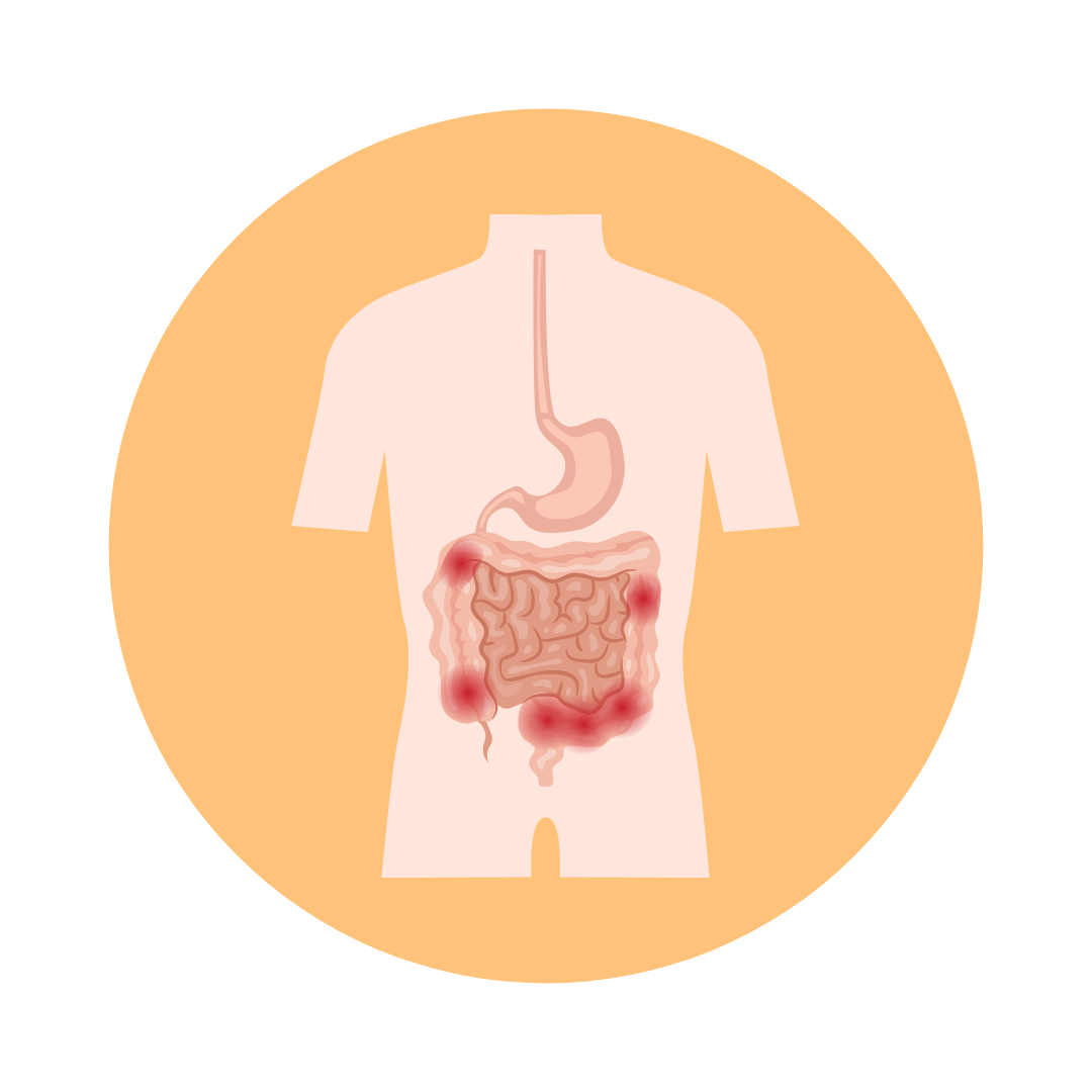 COLONIC HYDROTHERAPY